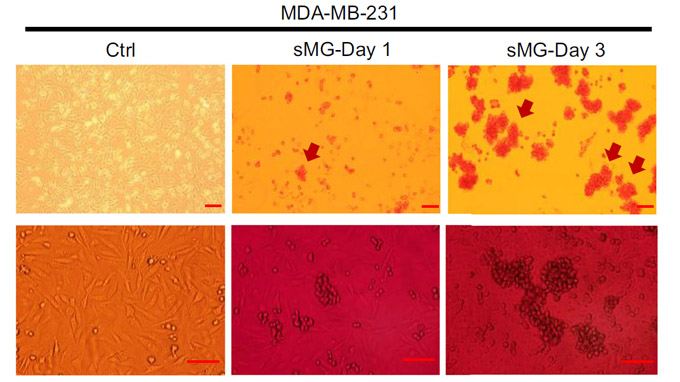 Simulated microgravity induces HIF-1- mediated metabolic reprogramming in triple-negative breast cancer cells